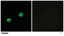 ARSI Rabbit anti-Human, Polyclonal Antibody, Abnova 100&mu;g; Unlabeled:Antibodies,