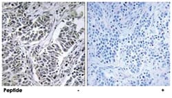 ATP5D Rabbit anti-Human, Mouse, Rat, Polyclonal Antibody, Abnova 100&mu;g;