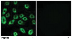 ATP5D Rabbit anti-Human, Mouse, Rat, Polyclonal Antibody, Abnova 100&mu;g;