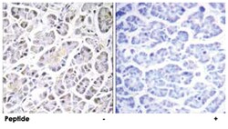 ATP5G3, Rabbit, Polyclonal Antibody, Abnova 100&mu;g; Unlabeled:Antibodies,