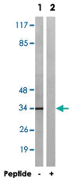 ATPAF2, Rabbit, Polyclonal Antibody, Abnova 100 &mu;g | Buy Online | Abnova Corporation | Fisher Scientific
