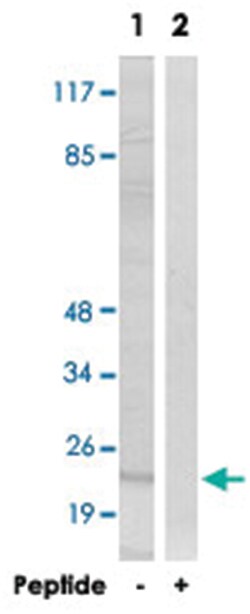 ATP5S, Rabbit, Polyclonal Antibody, Abnova 100&mu;g; Unlabeled:Antibodies,