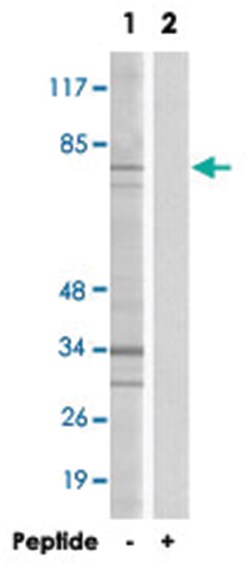 DDX51 Rabbit anti-Human, Polyclonal Antibody, Abnova 100&mu;g; Unlabeled:Antibodies,