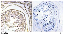 BAGE2, Rabbit, Polyclonal Antibody, Abnova 100&mu;g; Unlabeled:Antibodies,