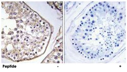 BAGE3, Rabbit, Polyclonal Antibody, Abnova 100 &mu;g | Buy Online | Abnova | Fisher Scientific