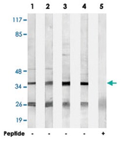 B3GALT1, Rabbit, Polyclonal Antibody, Abnova 100μg; Unlabeled:Antibodies,
