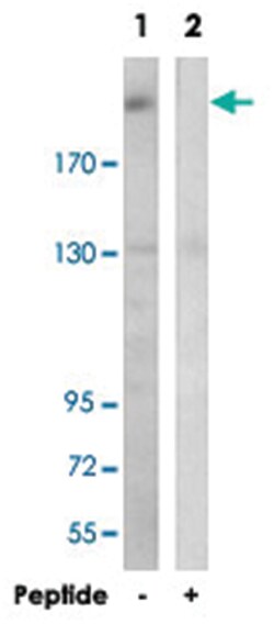 BRWD3, Rabbit, Polyclonal Antibody, Abnova 100 &mu;g | Buy Online | Abnova | Fisher Scientific