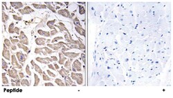 BRWD3, Rabbit, Polyclonal Antibody, Abnova 100 &mu;g | Buy Online | Abnova | Fisher Scientific