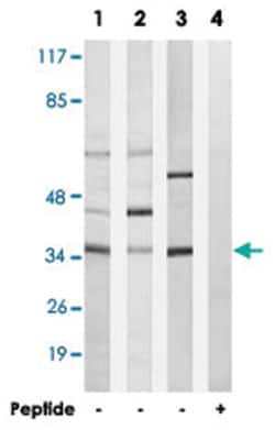 CA5A, Rabbit, Polyclonal Antibody, Abnova 100&mu;g; Unlabeled:Antibodies,