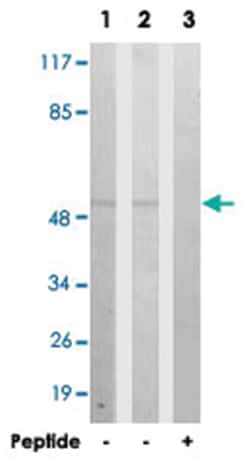 CPE, Rabbit, Polyclonal Antibody, Abnova 100&mu;g; Unlabeled:Antibodies,