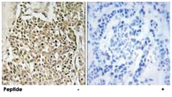 CEP350 Rabbit anti-Human, Polyclonal Antibody, Abnova 100&mu;g; Unlabeled:Antibodies,
