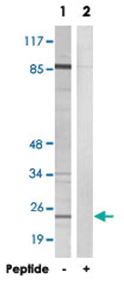 CBLN2, Rabbit, Polyclonal Antibody, Abnova 100 &mu;g | Buy Online | Abnova | Fisher Scientific
