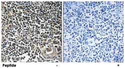 CBLN4, Rabbit, Polyclonal Antibody, Abnova 100&mu;g; Unlabeled:Antibodies,
