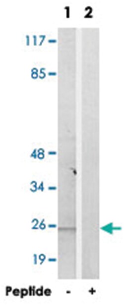 Abnova Corporation CMTM6 Rabbit anti-Human, Polyclonal Antibody, Abnova™