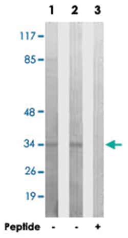 C1QL2, Rabbit, Polyclonal Antibody, Abnova 100&mu;g; Unlabeled:Antibodies,
