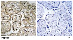 CST9L, Rabbit, Polyclonal Antibody, Abnova 100 &mu;g | Buy Online | Abnova Corporation | Fisher Scientific