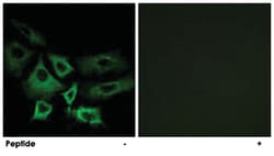 NT5C1A, Rabbit, Polyclonal Antibody, Abnova 100 &mu;g | Buy Online | Abnova Corporation | Fisher Scientific