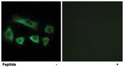 NT5C1B, Rabbit, Polyclonal Antibody, Abnova 100&mu;g; Unlabeled:Antibodies,