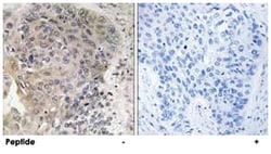 AGBL3, Rabbit, Polyclonal Antibody, Abnova 100&mu;g; Unlabeled:Antibodies,