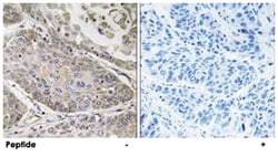 Abnova Corporation PLA2G4E, Rabbit, Polyclonal Antibody, Abnova™