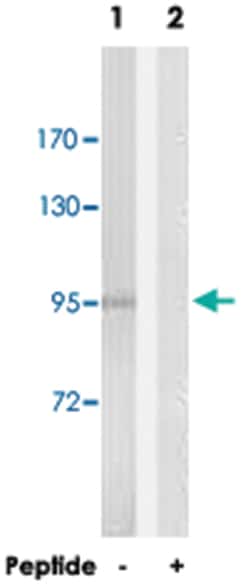 DLGAP5 Rabbit anti-Human, Polyclonal Antibody, Abnova 100&mu;g; Unlabeled:Antibodies,