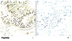 DYNLRB2, Rabbit, Polyclonal Antibody, Abnova 100&mu;g; Unlabeled:Antibodies,