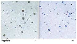 MARCH2, Rabbit, Polyclonal Antibody, Abnova 100&mu;g; Unlabeled:Antibodies,