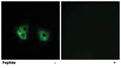 MARCH2, Rabbit, Polyclonal Antibody, Abnova 100&mu;g; Unlabeled:Antibodies,