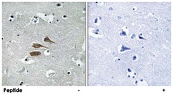MARCH3, Rabbit, Polyclonal Antibody, Abnova 100&mu;g; Unlabeled:Antibodies,
