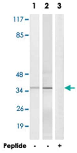 ELOVL1 Rabbit anti-Human, Mouse, Polyclonal Antibody, Abnova 100&mu;g;