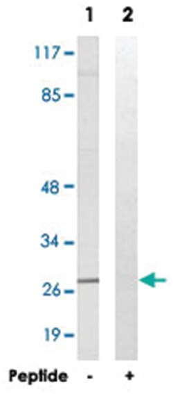 ELOVL5 Rabbit anti-Human, Polyclonal Antibody, Abnova 100&mu;g; Unlabeled:Antibodies,