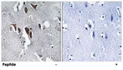 ELOVL5 Rabbit anti-Human, Polyclonal Antibody, Abnova 100&mu;g; Unlabeled:Antibodies,