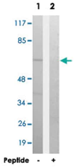 EIF3D, Rabbit, Polyclonal Antibody, Abnova 100 &mu;g | Buy Online | Abnova Corporation | Fisher Scientific