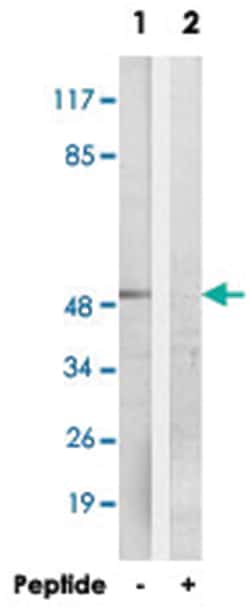 FOXN4, Rabbit, Polyclonal Antibody, Abnova 100&mu;g; Unlabeled:Antibodies,