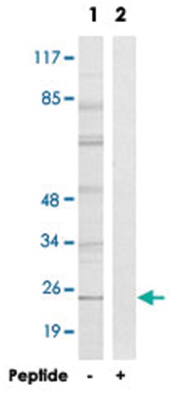 GJB7, Rabbit, Polyclonal Antibody, Abnova 100&mu;g; Unlabeled:Antibodies,