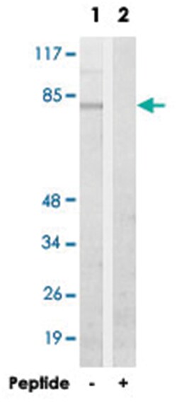 C2orf3, Rabbit, Polyclonal Antibody, Abnova 100 &mu;g | Buy Online | Abnova | Fisher Scientific