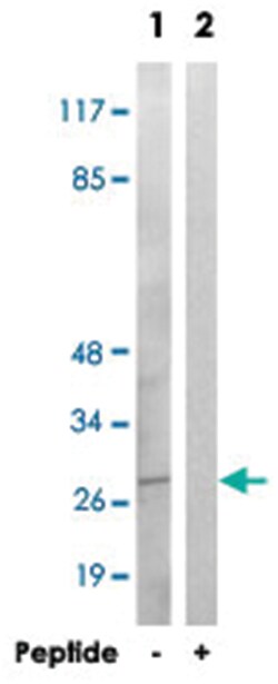 GFRA4 Rabbit anti-Human, Polyclonal Antibody, Abnova 100 &mu;g | Buy Online | Abnova | Fisher Scientific