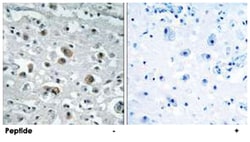 GPRASP1, Rabbit, Polyclonal Antibody, Abnova 100&mu;g; Unlabeled:Anticuerpos