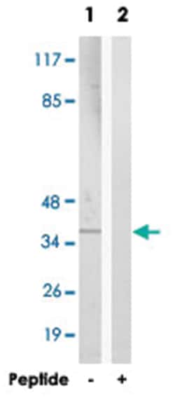 GHITM Rabbit anti-Human, Polyclonal Antibody, Abnova 100&mu;g; Unlabeled:Antibodies,