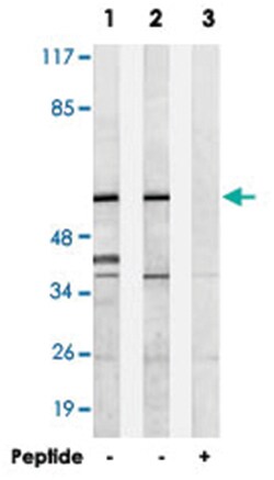 GBP3 Rabbit anti-Human, Polyclonal Antibody, Abnova 100&mu;g; Unlabeled:Antibodies,