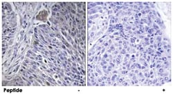 HNRPDL, Rabbit, Polyclonal Antibody, Abnova 100&mu;g; Unlabeled:Antibodies,