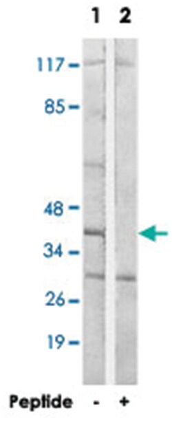 HLA-H, Rabbit, Polyclonal Antibody, Abnova 100 &mu;g | Buy Online | Abnova | Fisher Scientific