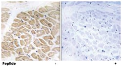 MIA, Rabbit, Polyclonal Antibody, Abnova 100&mu;g; Unlabeled:Antibodies,