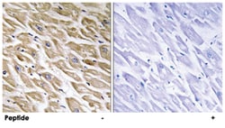 MRPL39, Rabbit, Polyclonal Antibody, Abnova 100&mu;g; Unlabeled:Antibodies,