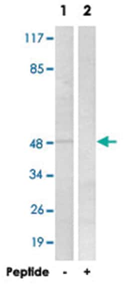 SLC16A3 Rabbit anti-Human, Mouse, Rat, Polyclonal Antibody, Abnova 100&mu;g;
