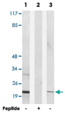 NDUFB9 Rabbit anti-Human, Mouse, Rat, Polyclonal Antibody, Abnova 100 &mu;g | Buy Online | Abnova | Fisher Scientific