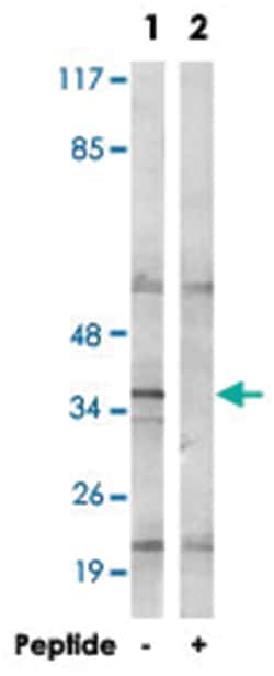 ND1 (MT-ND1), Rabbit, Polyclonal Antibody, Abnova 100&mu;g; Unlabeled:Antibodies,