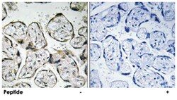 ND1 (MT-ND1), Rabbit, Polyclonal Antibody, Abnova 100&mu;g; Unlabeled:Antibodies,