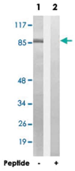 NOX5 Rabbit anti-Human, Polyclonal Antibody, Abnova 100&mu;g; Unlabeled:Antibodies,