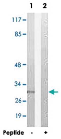 NCR3, Rabbit, Polyclonal Antibody, Abnova 100&mu;g; Unlabeled:Antibodies,
